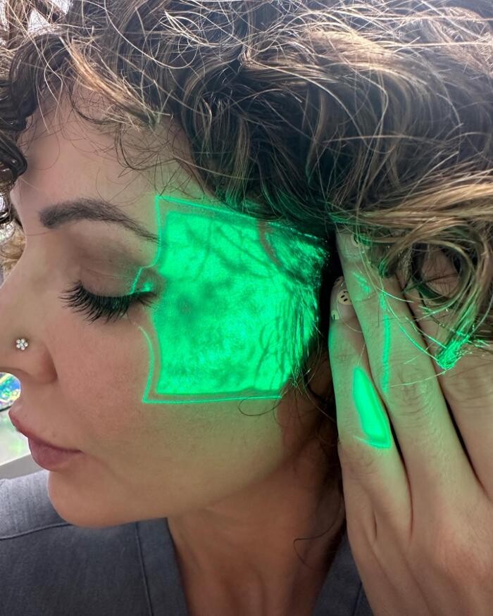 Images Glo Medspa