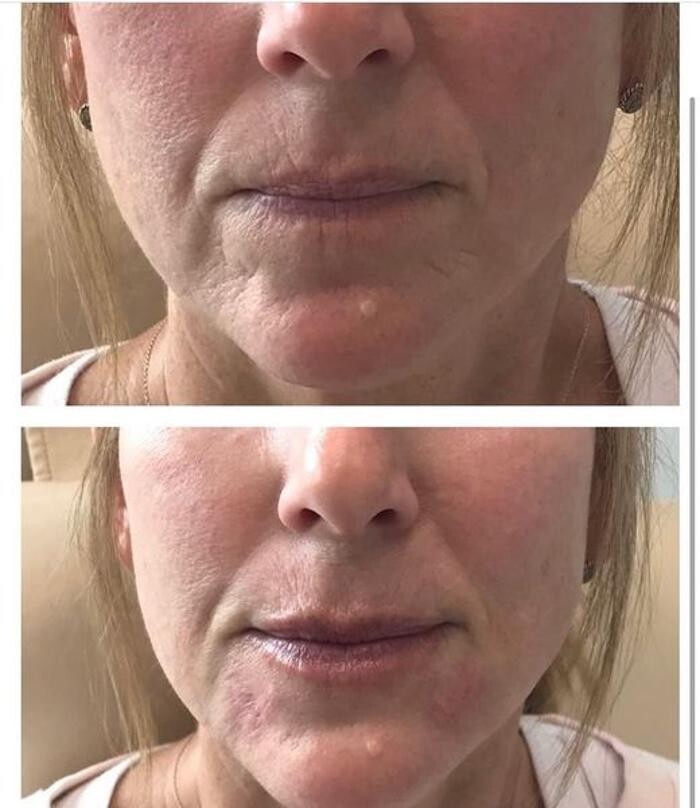 Images Glo Medspa