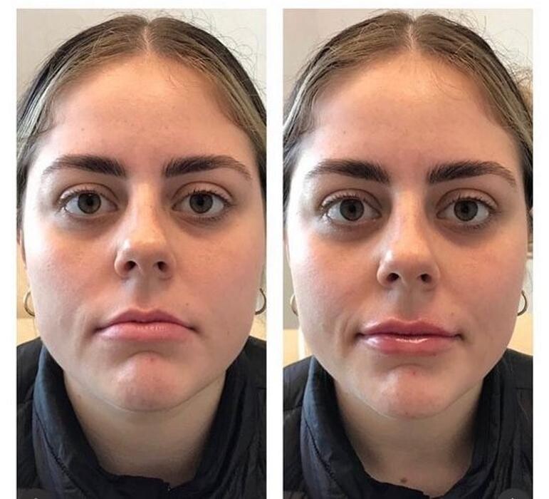 Images Glo Medspa