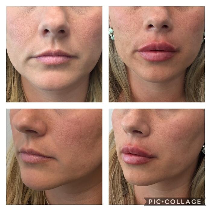 Images Glo Medspa