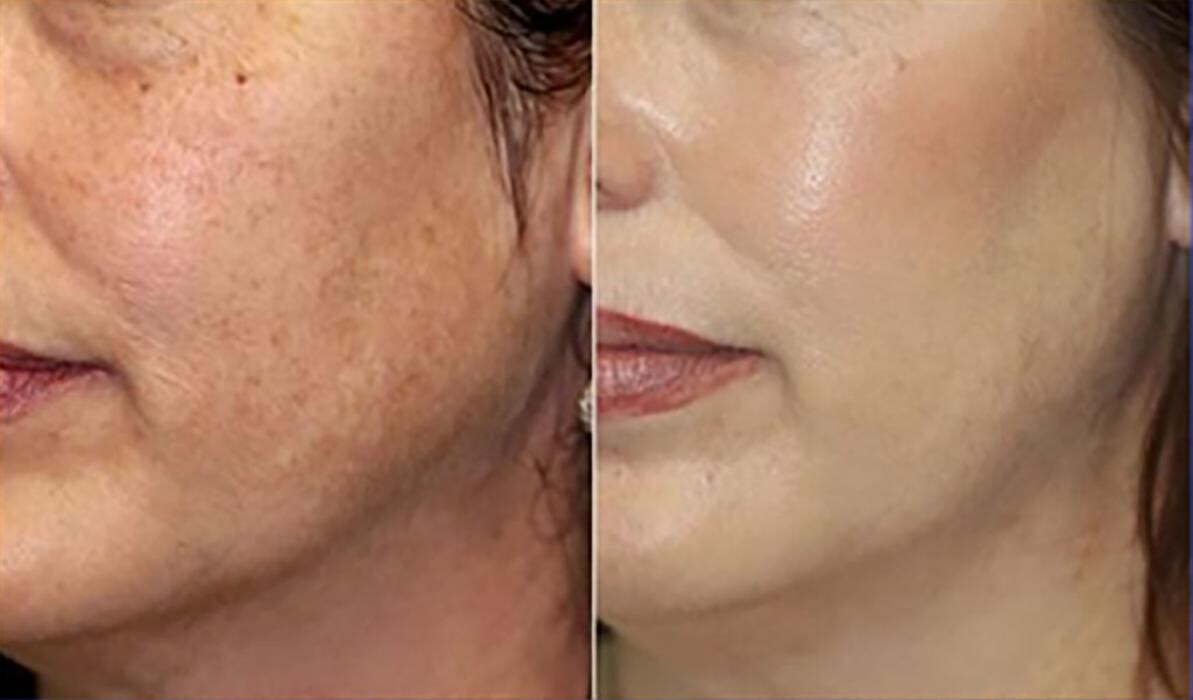 Images Glo Medspa