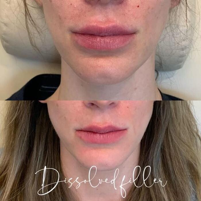 Images Glo Medspa