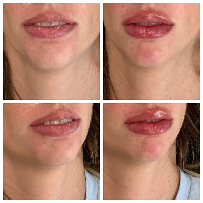 Images Glo Medspa