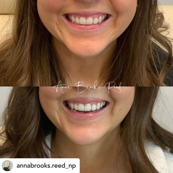 Images Glo Medspa