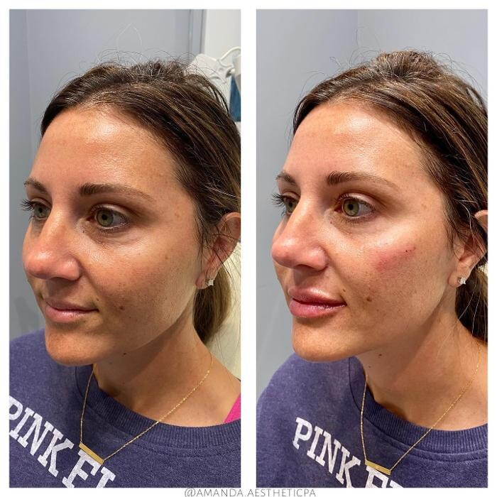 Images Glo Medspa