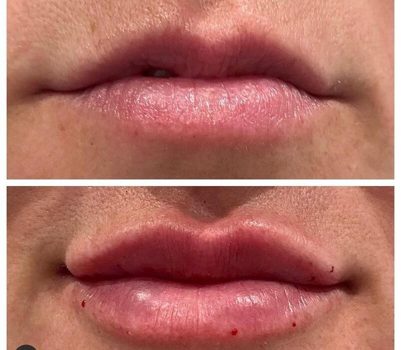 Images Glo Medspa