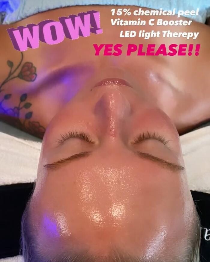 Images Glo Medspa