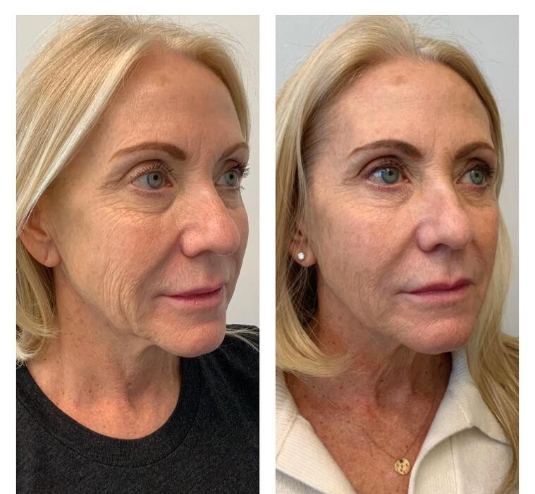 Images Glo Medspa