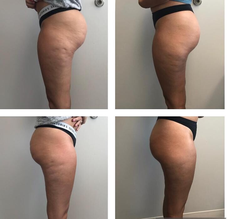 Images Glo Medspa