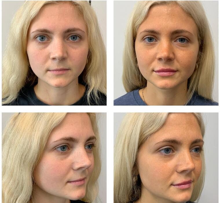 Images Glo Medspa