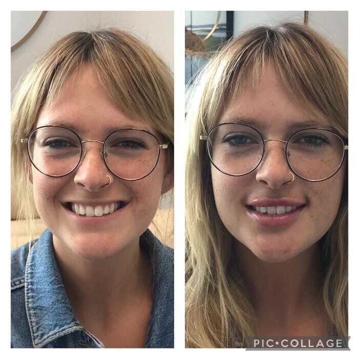 Images Glo Medspa