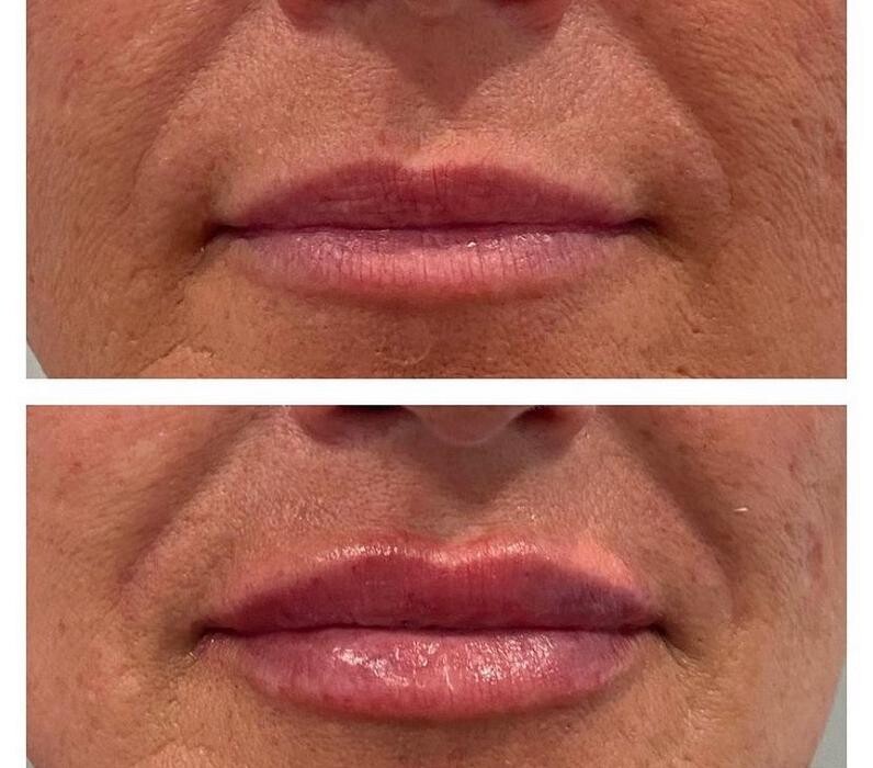 Images Glo Medspa