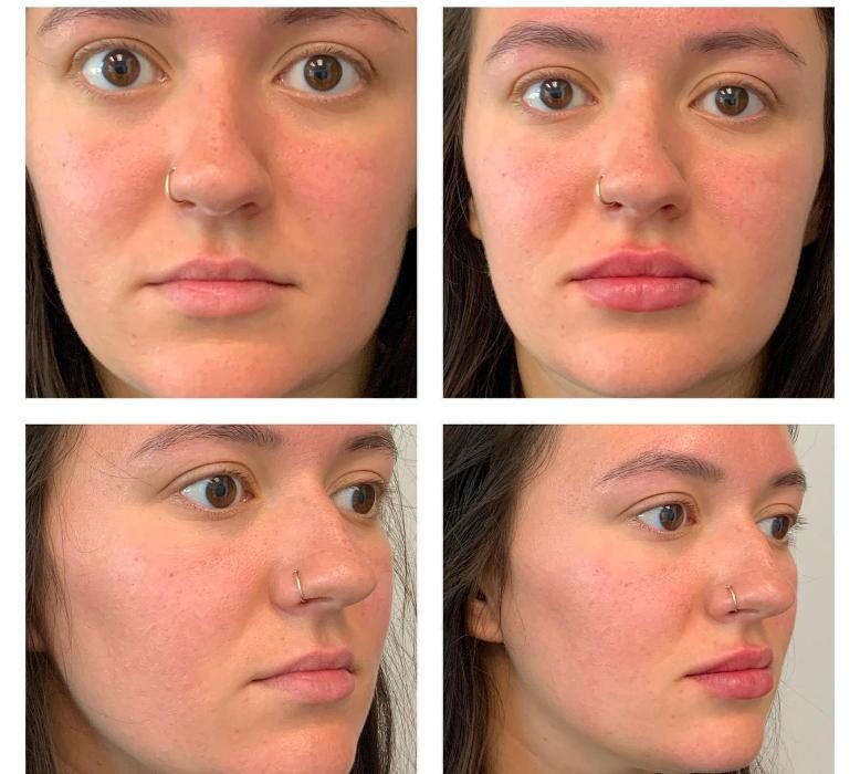 Images Glo Medspa