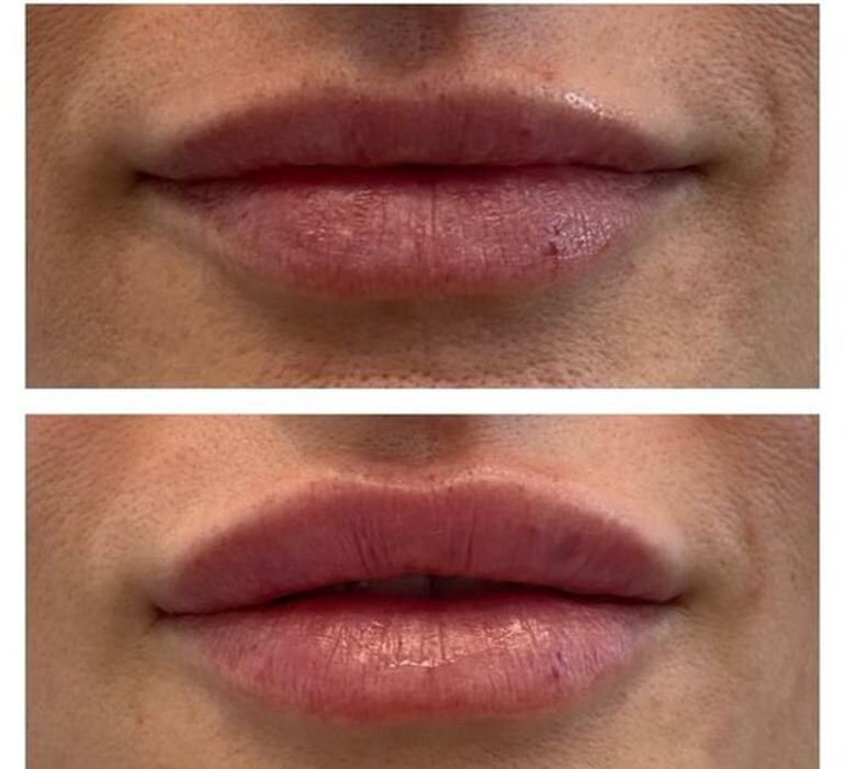 Images Glo Medspa