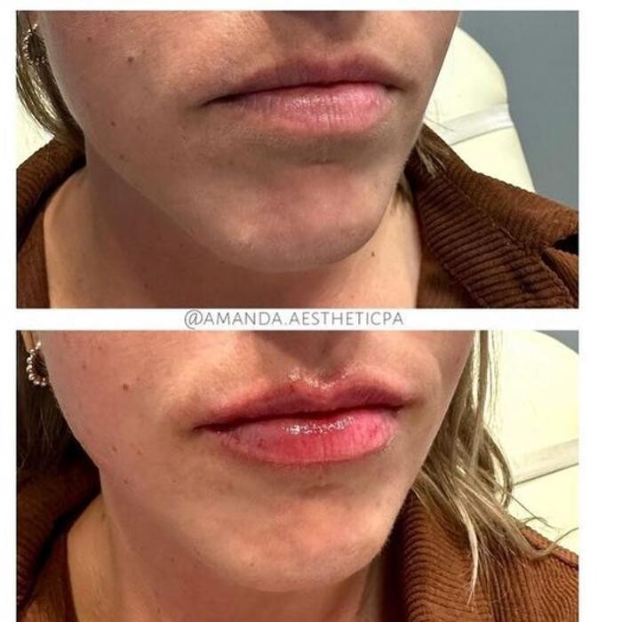 Images Glo Medspa
