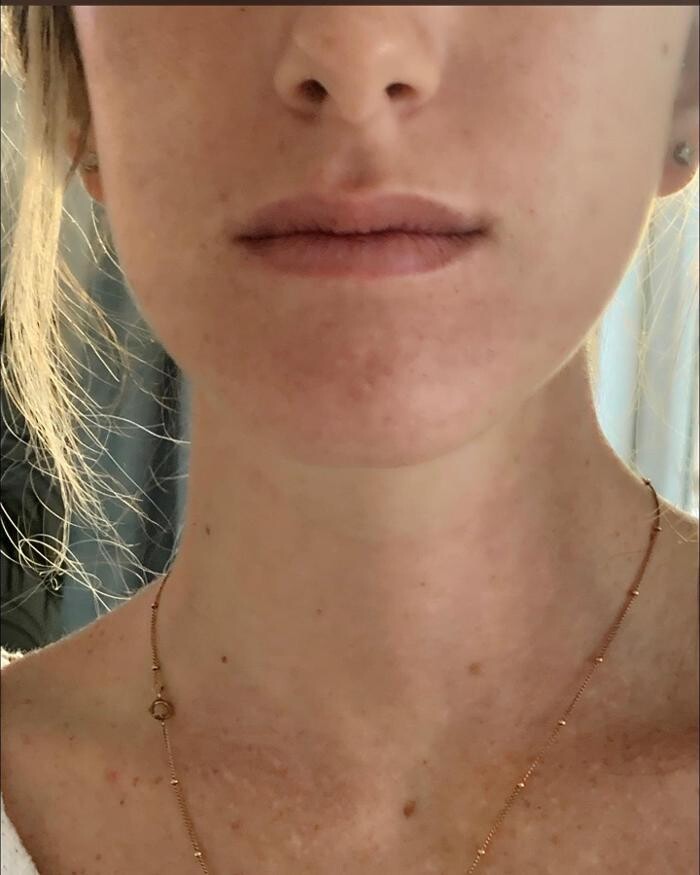 Images Glo Medspa
