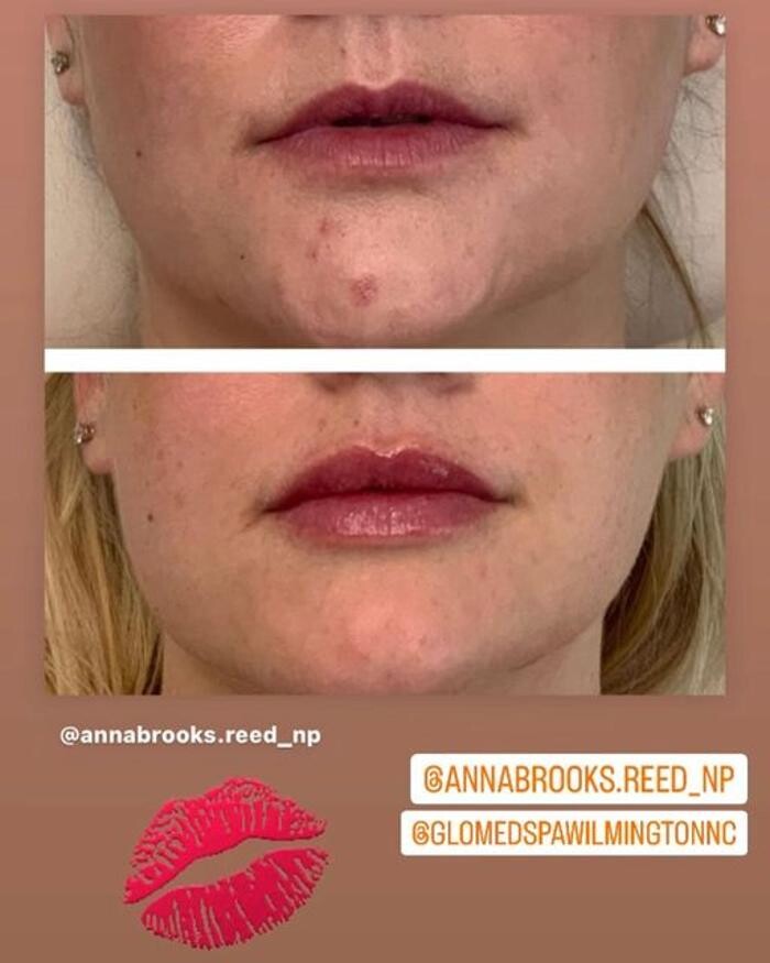 Images Glo Medspa