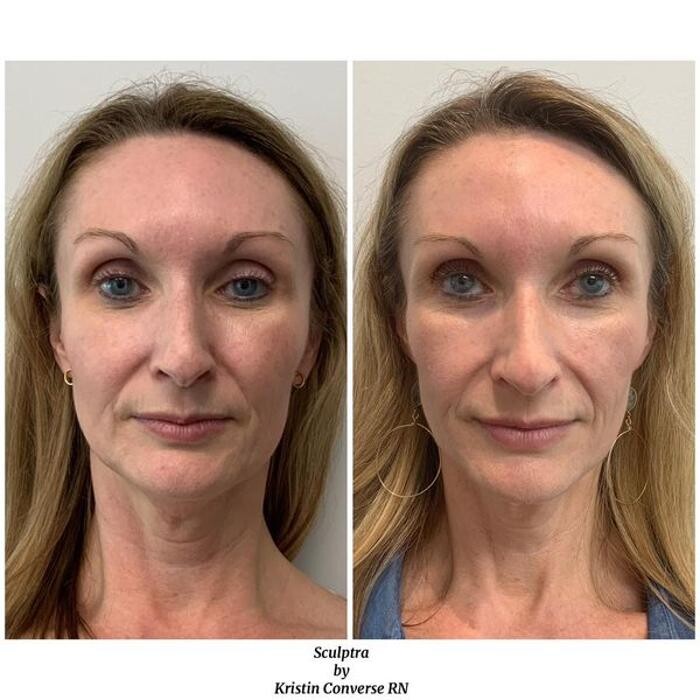 Images Glo Medspa