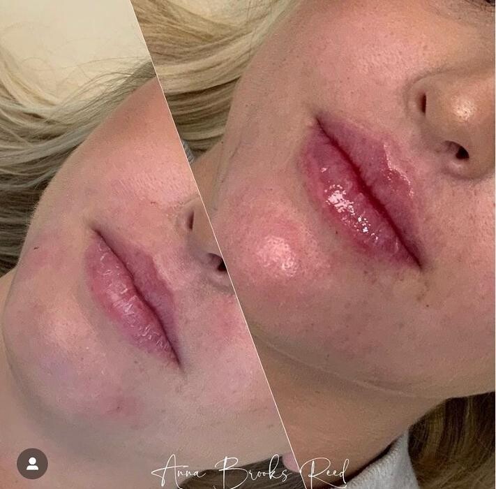 Images Glo Medspa