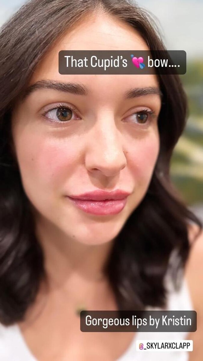 Images Glo Medspa