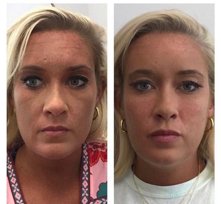 Images Glo Medspa