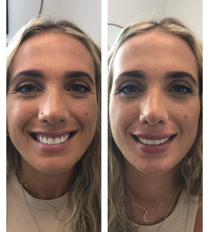 Images Glo Medspa