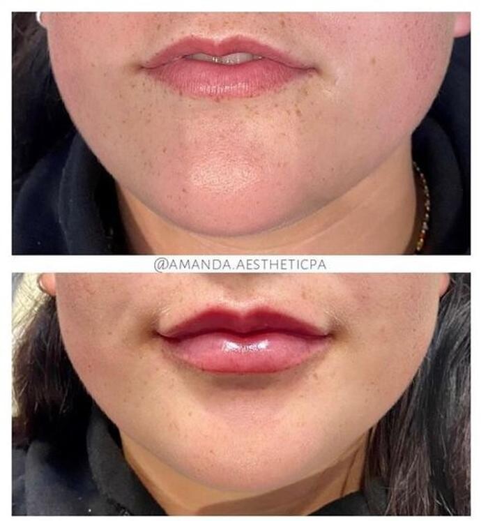 Images Glo Medspa