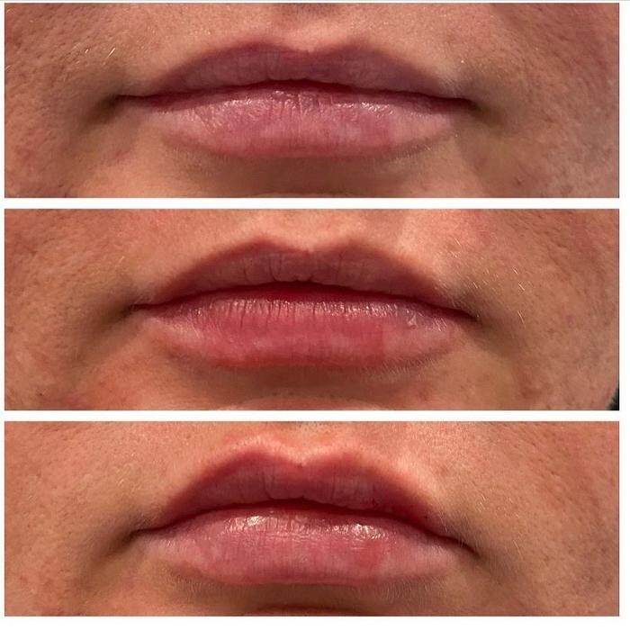 Images Glo Medspa