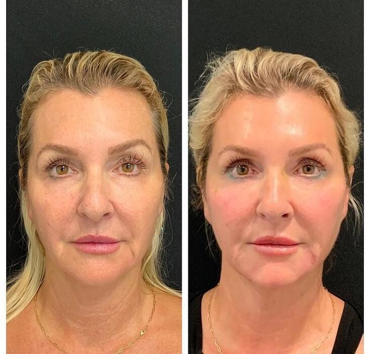 Images Glo Medspa