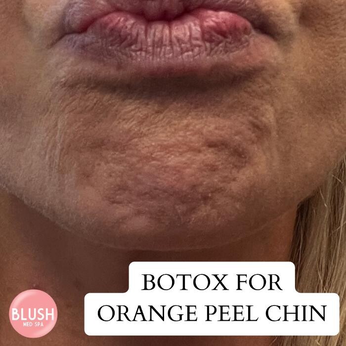 Images Blush Med Spa