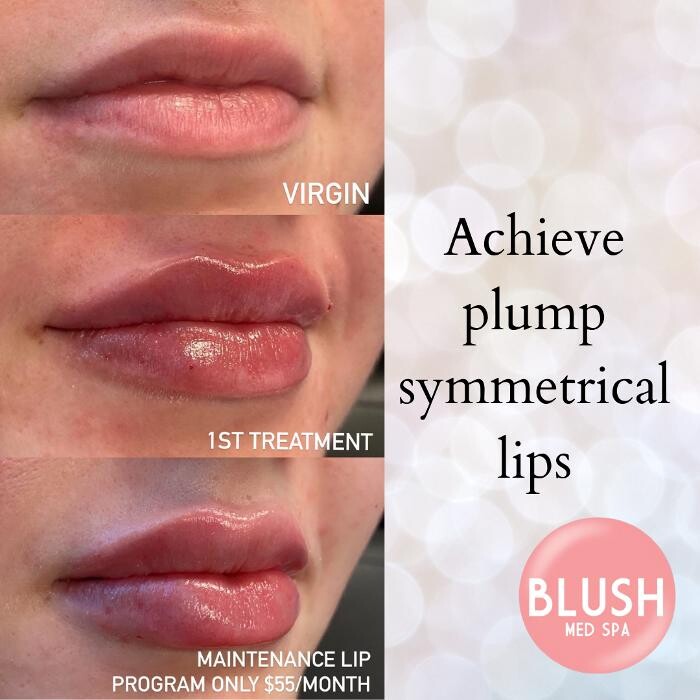 Images Blush Med Spa