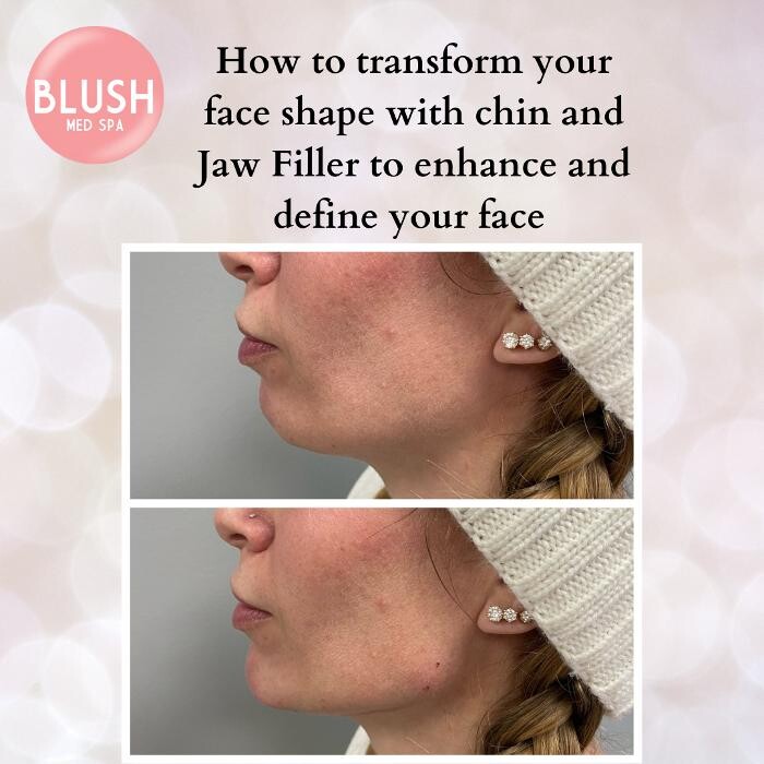 Images Blush Med Spa