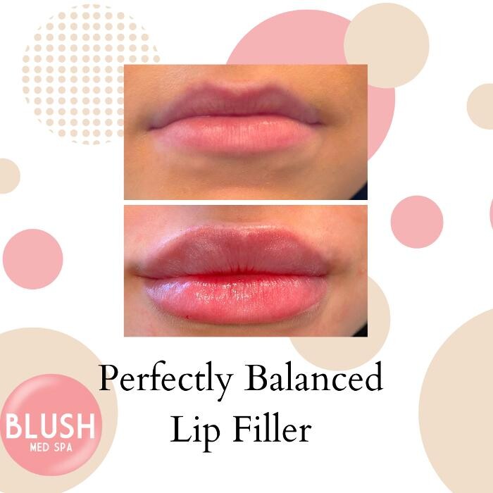 Images Blush Med Spa