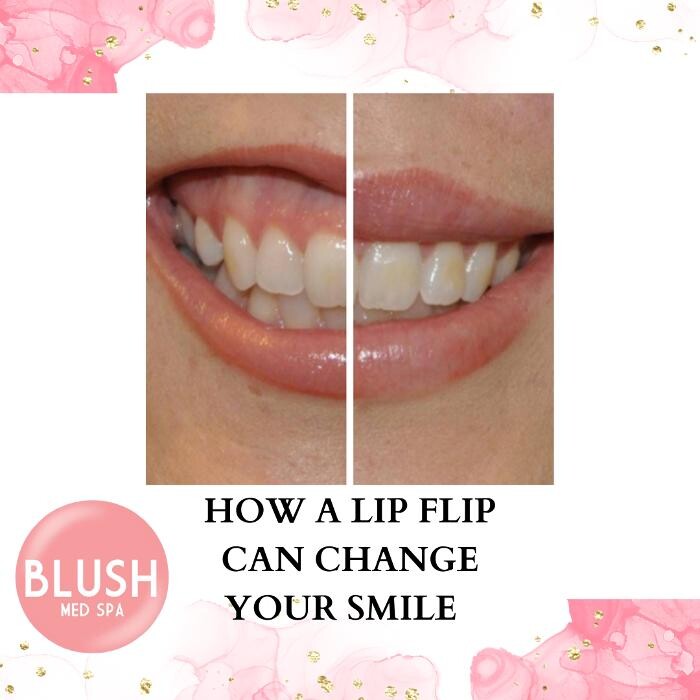 Images Blush Med Spa