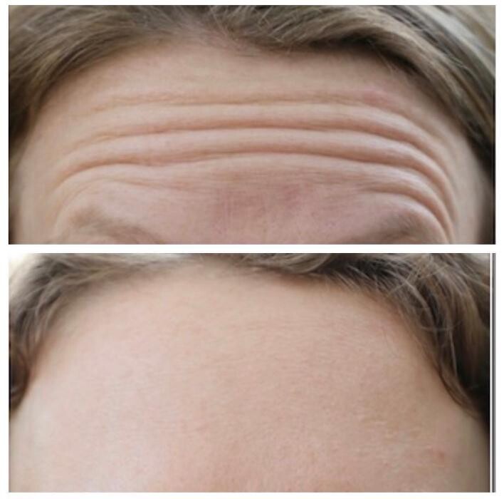 Images Blush Med Spa