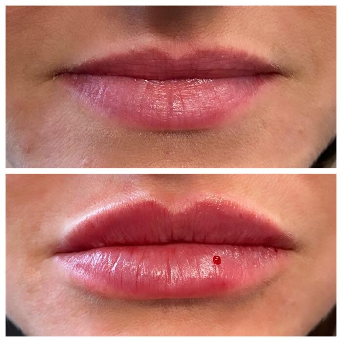 Images Blush Med Spa