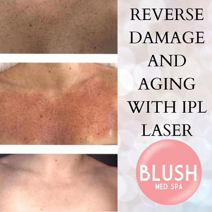 Images Blush Med Spa