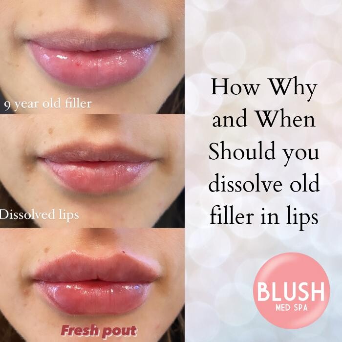 Images Blush Med Spa