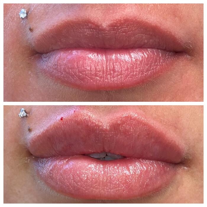 Images Blush Med Spa