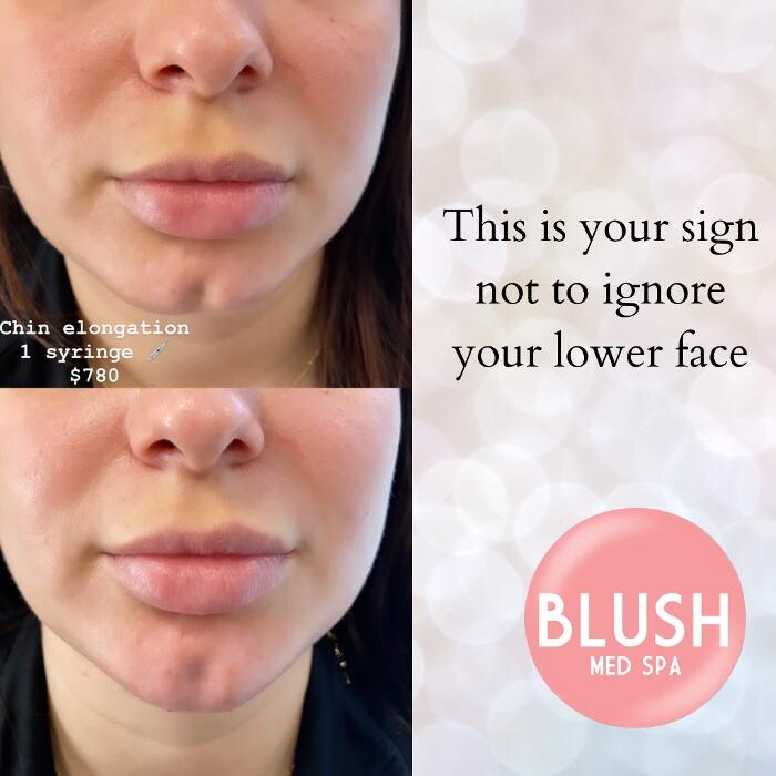 Images Blush Med Spa