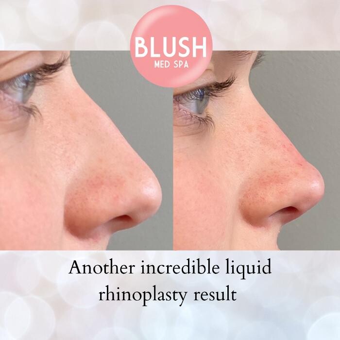 Images Blush Med Spa