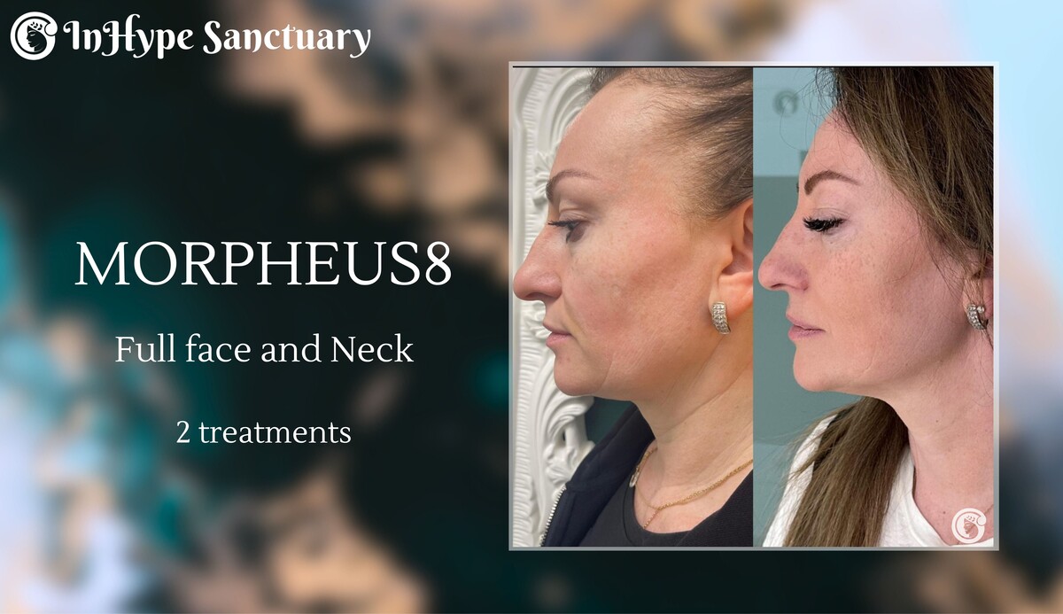 Images Inhype Sanctuary Med Spa
