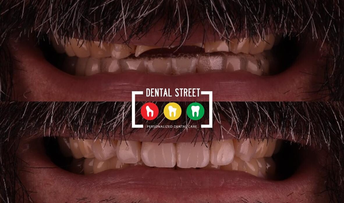 Images Dental Street