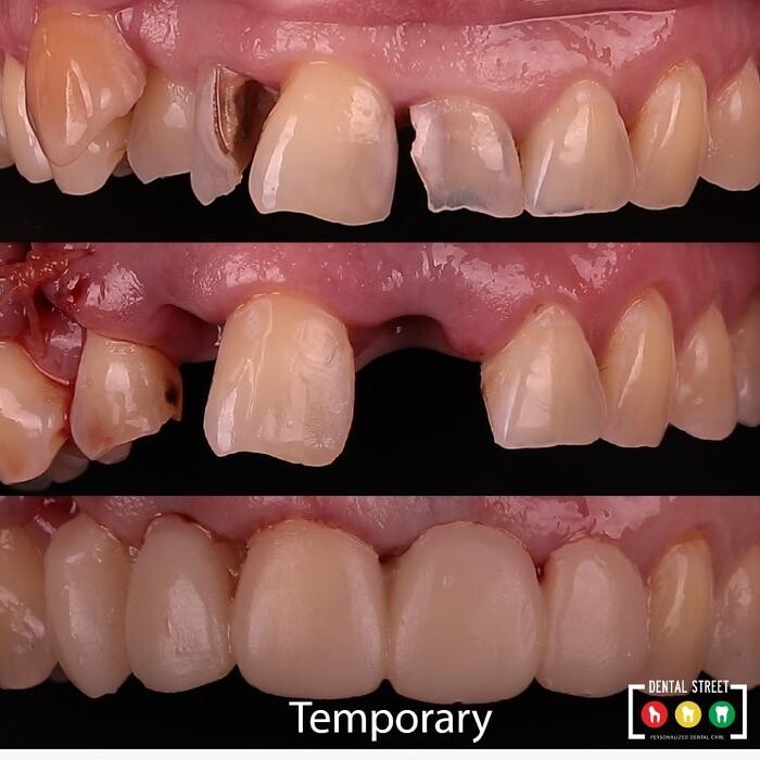 Images Dental Street