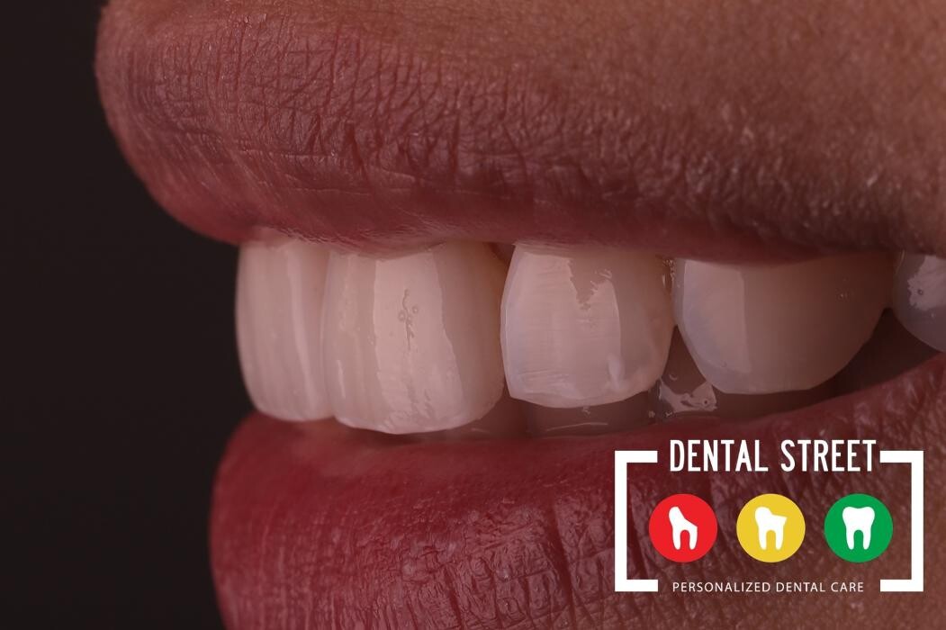 Images Dental Street