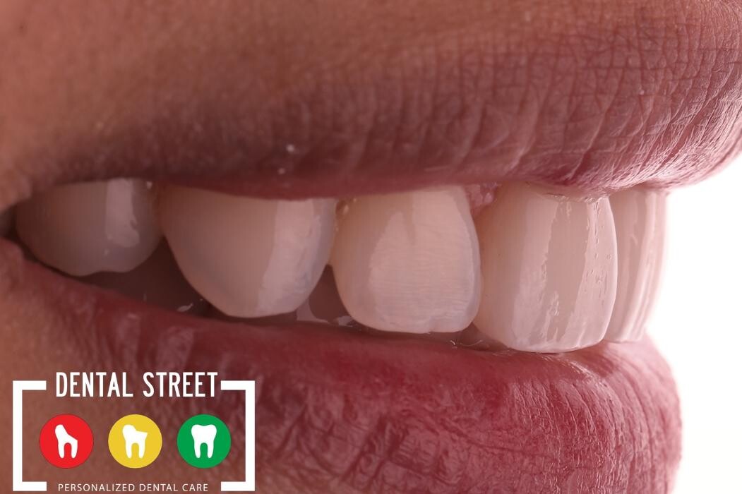 Images Dental Street