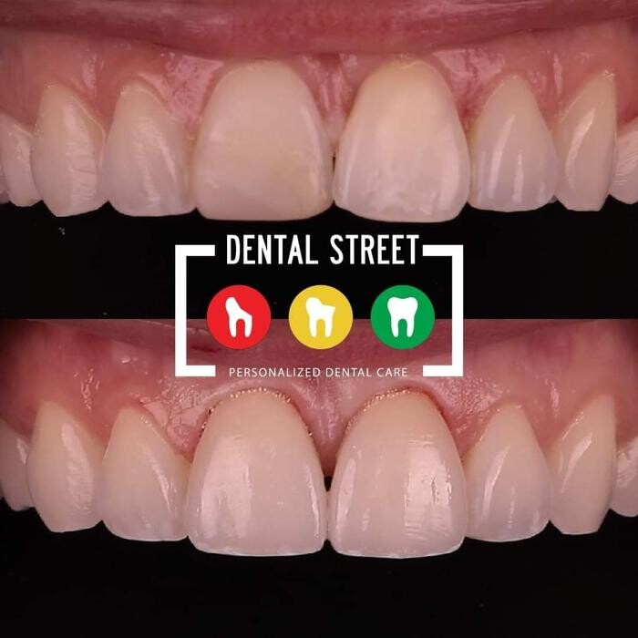 Images Dental Street