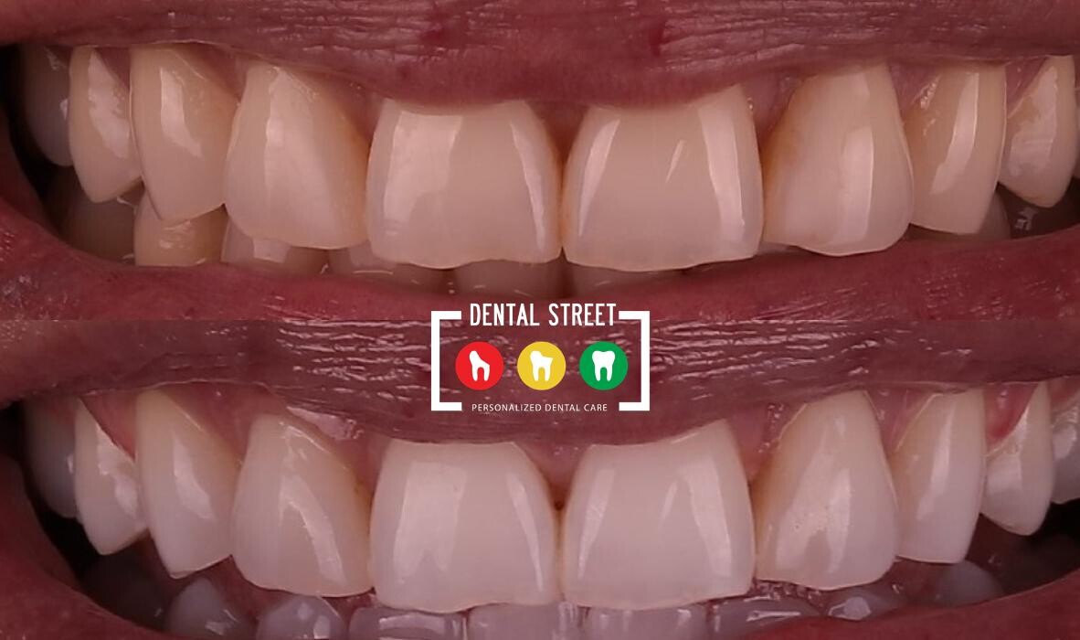 Images Dental Street