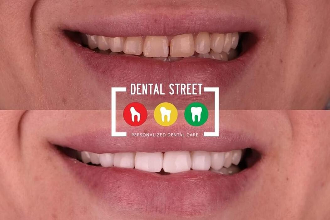 Images Dental Street