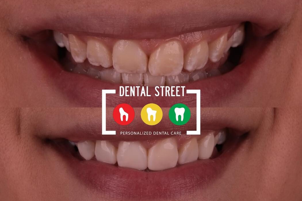 Images Dental Street